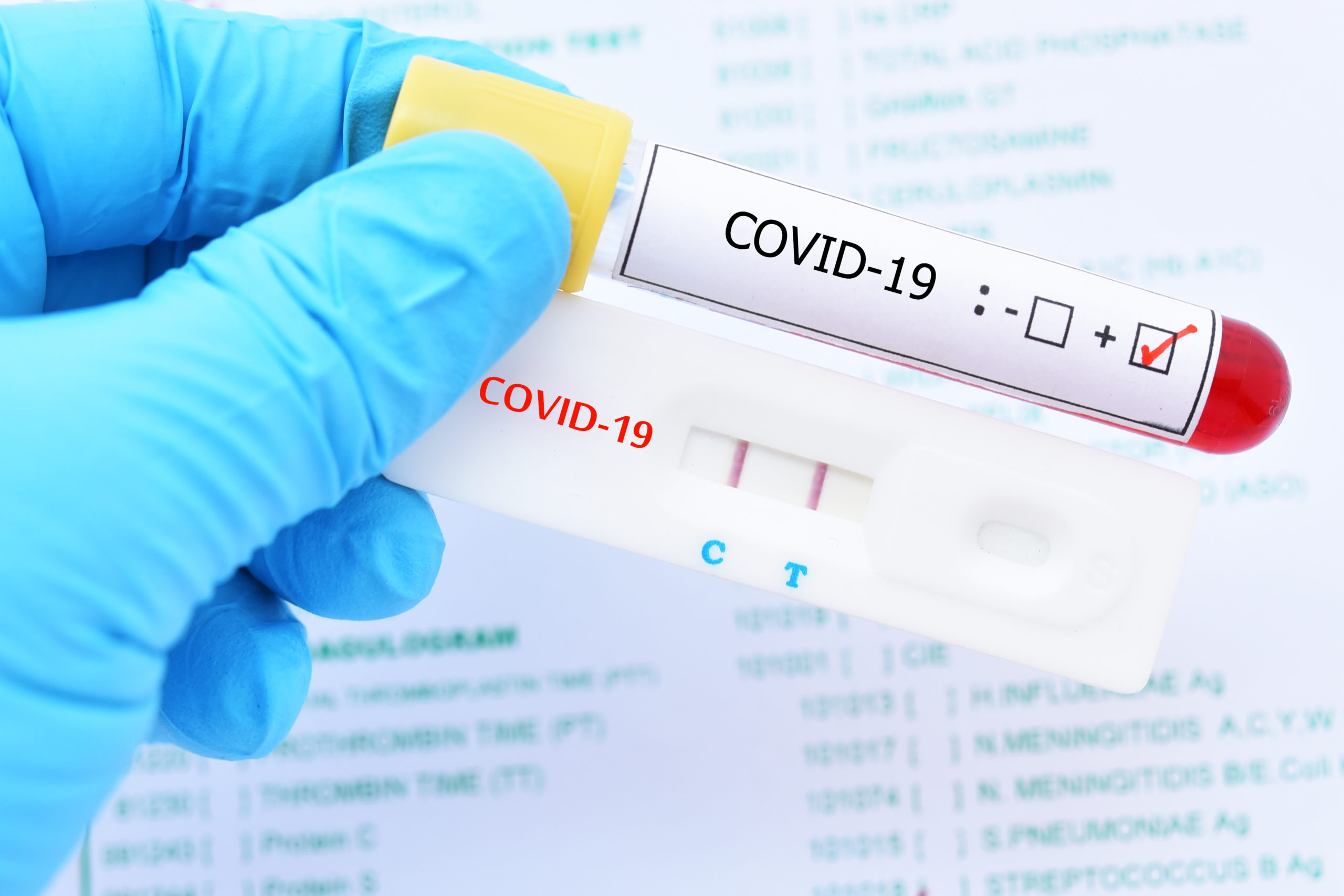 Rapid antigen test; the perfect way to stop COVID-19 from spreading